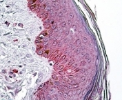 IHC staining of FFPE human skin with PNPLA3 antibody at 4ug/ml. HIER: steamed with pH6 citrate buffer, AP-staining.