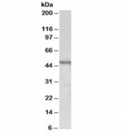 Western blot testing of Daudi lysate with CHIT1 antibody at 1ug/ml. Predicted molecular weight: ~52kDa.
