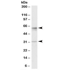 Western blot testing of human placenta lysate with SLC17A5 antibody at 1ug/ml. Predicted molecular weight: ~55/31kDa (isoforms 1/2).