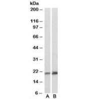 Western blot of pig skeletal muscle (A) and heart (B) lysates with CAV3 antibody at 0.1ug/ml. Predicted molecular weight: ~17kDa but routinely observed at 20~25kDa.