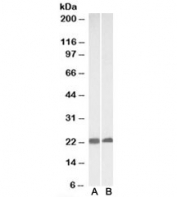 Western blot of mouse (A) and rat (B) heart lysates with CAV3 antibody at 0.3ug/ml. Predicted molecular weight: ~17kDa but routinely observed at 20~25kDa.