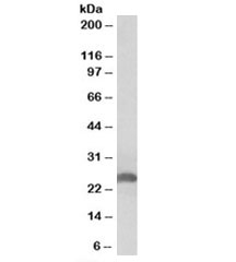 Western blot testing of human liver lysate with Apolipoprotein D antibody at 0.3ug/ml. Predicted molecular weight: ~21/21-33kDa (unmodified/glycosylated). ~