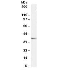 Western blot testing of human testis lysate with TACR1 antibody at 1ug/ml. Predicted molecular weight: ~36kDa.