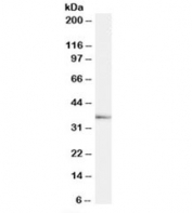 Western blot testing of human testis lysate with TACR1 antibody at 1ug/ml. Predicted molecular weight ~46kDa but routinely observed at ~58kDa. Image shows detection of the 