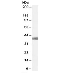 Western blot testing of mouse liver lysate with AGTR1 antibody at 0.3ug/ml. Predicted molecular weight: ~41kDa.