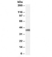 Western blot testing of mouse liver lysate with AGTR1 antibody at 0.3ug/ml. Observed molecular weight: 41-50 kDa depending on glycosylation level.