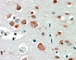 IHC staining of FFPE human brain cortex with GABRA4 antibody at 2.5ug/ml. HIER: steamed with pH6 citrate buffer, AP-staining.
