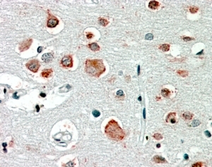 IHC staining of FFPE human brain cortex with GABRA4 antibody at 2.5ug/ml. HIER: steamed with pH6 citrate buffer,