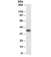Western blot testing of human colon lysate with Clusterin antibody at 0.3ug/ml. Predicted molecular weight: ~75kDa (heterodimer precursor), 36-39kDa (alpha subunit), 34-36kDa (beta subunit).