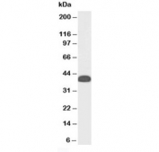 Western blot testing of human testis lysate with Clu antibody at 0.3ug/ml. Predicted molecular weight: 75-80 kDa (heterodimer precursor), 36-39 kDa (alpha subunit), 34-36 kDa (beta subunit).