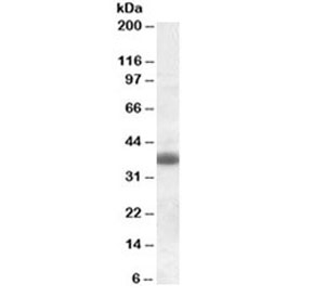 Western blot testing of rat brain lysate with Clu antibody at 0.3ug/ml. Predicted molecular weight: ~75kDa (heterodimer precursor), 36-39kDa (alpha subunit), 34-36kDa (beta subunit).