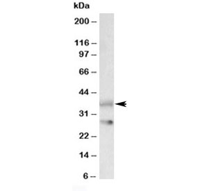 Western blot testing of rat brain lysate with Clu antibody at 0.1ug/ml. Predicted molecular weight: 75-80kDa (heterodimer precursor), 36-39kDa (alpha subunit), 34-36kDa (beta subunit).