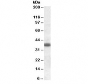 Western blot testing of rat brain lysate with Clu antibody at 0.3ug/ml. Predicted molecular weight: 75-80 kDa (heterodimer precursor), 36-39 kDa (alpha subunit), 34-36 kDa (beta subunit).