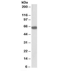 Western blot testing of human liver lysate with BTD antibody at 0.5ug/ml. Predicted molecular weight: ~61kDa.