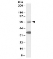 Western blot testing of peripheral blood lymphocyte lysate with TRIM29 antibody at 1ug/ml. Both the expected ~66kDa band and the additional ~37kDa band block with the addition of immunizing peptide.