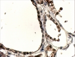 IHC testing of FFPE human thyroid gland with DUOX1 antibody at 4ug/ml. HIER: steamed with pH9 Tris/EDTA buffer, HRP-staining.