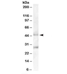 Western blot testing of human pancreas lysate with B3GNT2 antibody at 0.1ug/ml. Predicted molecular weight: ~46kDa. Both observed bands are blocked by addition of immunizing peptide.