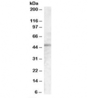 Western blot testing of A431 cell lysate with TMPRSS3 antibody at 0.1ug/ml. Predicted molecular weight: ~49kDa.