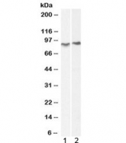 Western blot testing of 1) mouse lung and 2) rat lung lysate with ACAP2 antibody at 0.3ug/ml. Predicted molecular weight: ~88kDa.