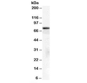 Western blot testing of A431 cell lysate with HSPA8 antibody at 2ug/ml. Predicted/observed molecular weight: ~71/70-73kDa.