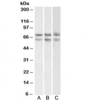 Western blot testing of A) HeLa, B) HepG2, and C) K562 nuclear lysates with GNL3 antibody at 2ug/ml. Predicted molecular weight: ~62/60kDa (isoforms 1/2). The observed ~75kDa band likely represents the acetylated form of the protein.