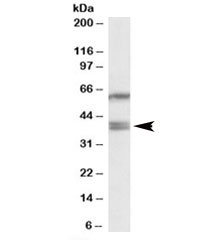 Western blot testing of HepG2 lysate with PON2 antibody at 0.2ug/ml. Predicted molecular weight: ~39/39/38kDa (isoforms 1/2/3). The three observed bands are blocked by addition of immunizing peptide.