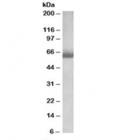 Western blot testing of human testis lysate with BBS4 antibody at 1ug/ml. Predicted molecular weight: ~58kDa.