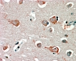 IHC testing of FFPE human cortex with GABRB3 antibody at 2.5ug/ml. HIER: steamed with pH6 citrate buffer, AP-staining.