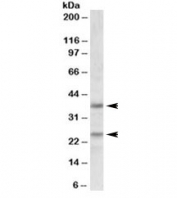 Western blot testing of human cerebellum lysate with Podoplanin antibody at 1ug/ml. Predicted molecular weight ~25/36kDa (unmodified/glycosylated).