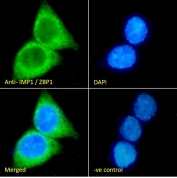 Western blot testing of K562 lysate with ZBP-1 antibody at 0.3ug/ml. Predicted molecular weight: ~64 kDa.