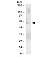 Western blot testing of A431 lysate with GRB7 antibody at 2ug/ml. Predicted molecular weight: ~60kDa.~
