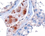 IHC staining of FFPE human testis with STK35 antibody at 10ug/ml. HIER: microwaved with pH9 Tris/EDTA buffer, HRP-staining.