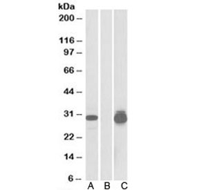 Western blot testing ofHEK293 lysate overexpressing human PPPDE1-MYC probed with PPPDE1 antibody (0.5ug/ml) in Lane A and anti-MYC (1/5000) in lane C. Mock-transfected HEK293 probed with PPPDE1 antibody (1ug/ml) in Lane B.~