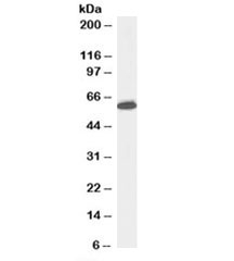 Western blot testing of Jurkat lysate with Nup50 antibody at 0.5ug/ml. Predicted molecular weight: observed at ~50 or ~60kDa.~