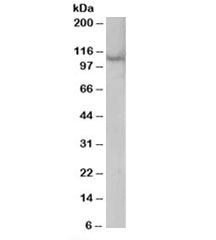 Western blot testing of A431 lysate with Rabenosyn 5 antibody at 0.3ug/ml. Predicted molecular weight: ~89kDa but commonly observed at ~110kDa.