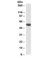 Western blot testing of breast cancer lysate with SLC40A1 antibody at 1ug/ml. Predicted molecular weight: ~62kDa.