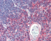 IHC testing of FFPE human thymus tissue with TXK antibody at 5ug/ml. Required HIER: steamed antigen retrieval with pH6 citrate buffer; AP-staining.