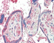 IHC testing of FFPE human placental tissue with TXK antibody at 5ug/ml. Required HIER: steamed antigen retrieval with pH6 citrate buffer; AP-staining.