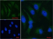 IF/ICC testing of human HeLa cells with PTCH1 antibody at 5ug/ml + DAPI nuclear stain (blue).