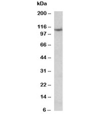 Western blot testing of thyroid gland lysate with Thyroid peroxidase antibody at 0.1ug/ml. Predicted molecular weight ~103kDa.~