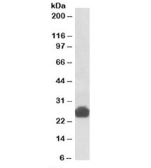 Western blot testing of rat liver lysate with Gsta5 antibody at 0.3ug/ml. Predicted molecular weight: ~25kDa.