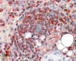 IHC staining of FFPE human spleen with ARPC2 antibody at 4ug/ml. HIER: steamed with pH6 citrate buffer, AP-staining.
