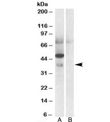 Western blot testing of human placenta lysate with Apolipoprotein L4 antibody at 0.5ug/ml with [B] and without [A] blocking/immunizing peptide. Predicted molecular weight: ~39kDa.~