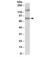 Western blot testing of human hippocampus lysate with EPB41L5 antibody at 1ug/ml. The expected ~80 kDa band and the additional ~140 kDa band are both blocked by the immunizing peptide.