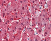 IHC staining of FFPE human liver with Argininosuccinate synthetase 1 antibody at 2.5ug/ml. HIER: steamed with pH6 citrate buffer, AP-staining.