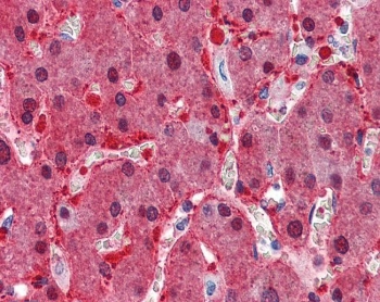 IHC staining of FFPE human liver with Argininosuccinate synthetase 1 antibody at 2.5ug/ml. HIER: steamed with pH6 citrate buffer, AP-staining.