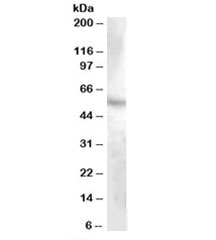 Western blot testing of human kidney lysate with DMP1 antibody at 1ug/ml. Predicted molecular weight: ~56kDa.