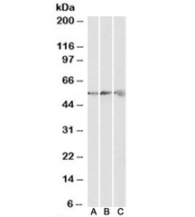 Western blot testing of human [A], mouse [B] and rat [C] heart lysates with ATP5B antibody at 0.3ug/ml. Predicted molecular weight: ~56kDa.~