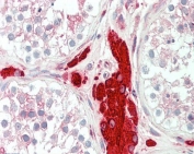 IHC testing of FFPE human testis tissue with PGRMC1 antibody at 5ug/ml. Required HIER: steamed antigen retrieval with pH6 citrate buffer; AP-staining.