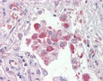 IHC testing of FFPE human lung with OSBPL9 antibody at 2.5ug/ml. HIER: steamed with pH6 citrate buffer, AP-staining.